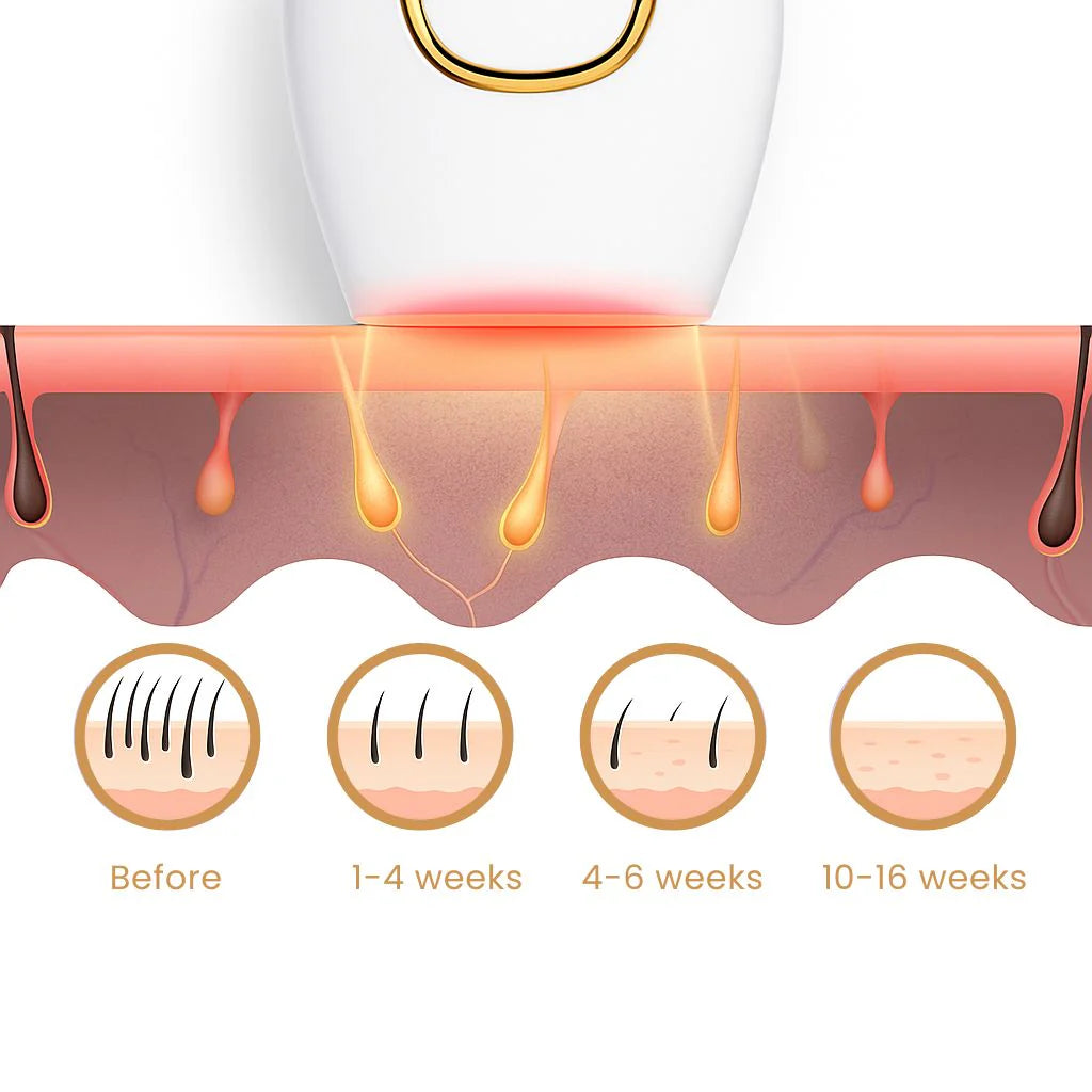 Mini Laser Hair Removal Portable / جهاز إزالة الشعر بالليزر القابل للحمل